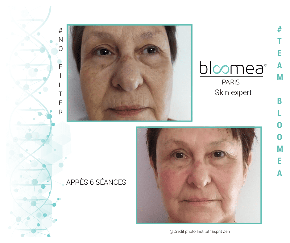 massage-moidieu-detourbe